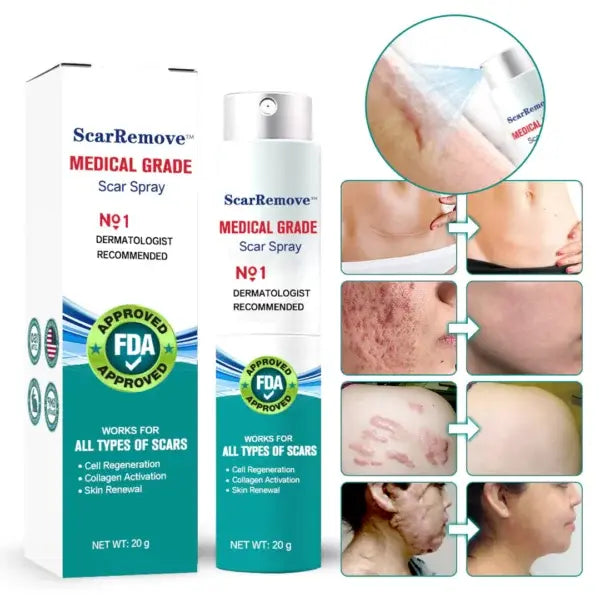 POLANDSHOPY™ Fivfivgo Advanced Scar Removal Spray