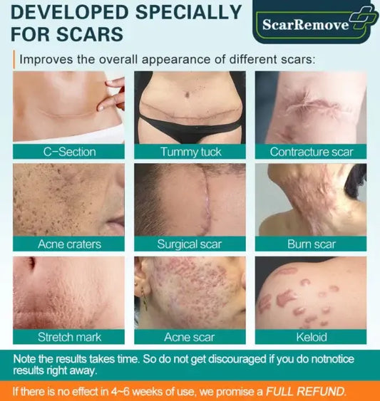 POLANDSHOPY™ Fivfivgo Advanced Scar Removal Spray